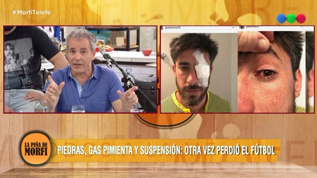 Ariel Rodríguez te cuenta todo sobre la suspensión de la final | Mejores momentos