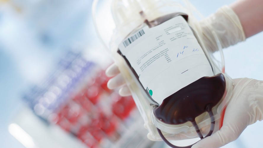 Todo lo que tenes que saber para donar sangre | Health