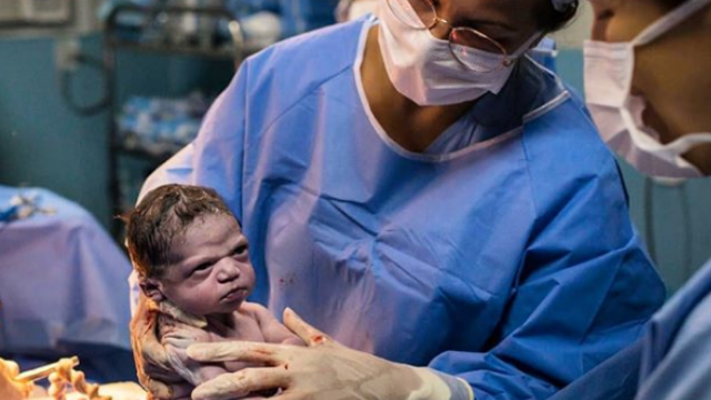 Nació y se convirtió en MEME: la foto del “bebé enojado” que es furor | Virales