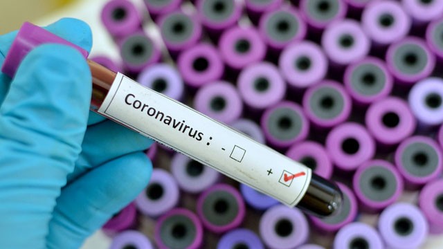 Un hombre de 100 años se recuperó del Coronavirus | Sociedad
