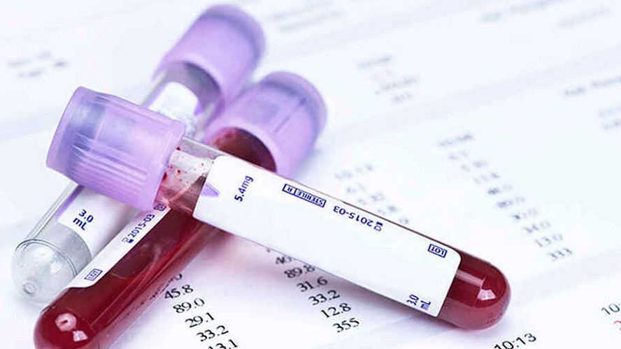 Un test dectectaría el cáncer anticipadamente | Salud