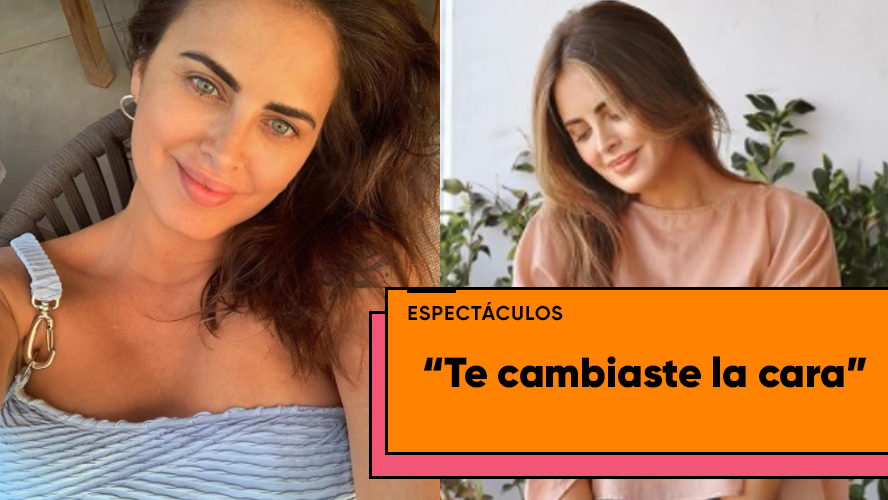 Silvina Luna publicó una foto y sus fans creen que se hizo un retoque facial | Espectáculos