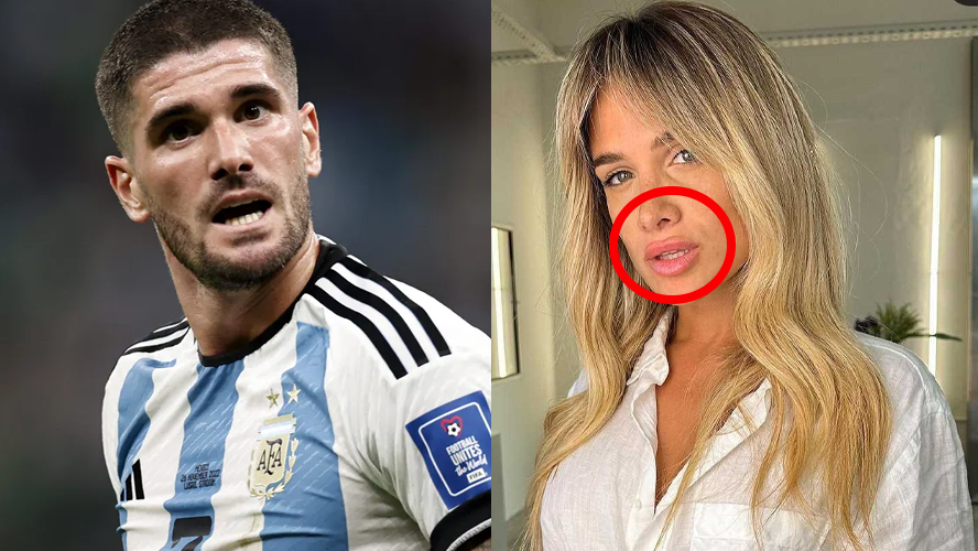 Camila Homs se hizo un retoque estético y la criticaron en las redes | Espectáculos