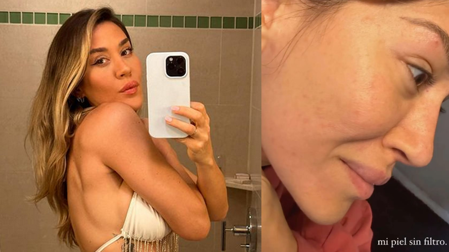 Jimena Barón mostró cómo reacciona su cuerpo cuando se alimenta de comida chatarra | Espectáculos