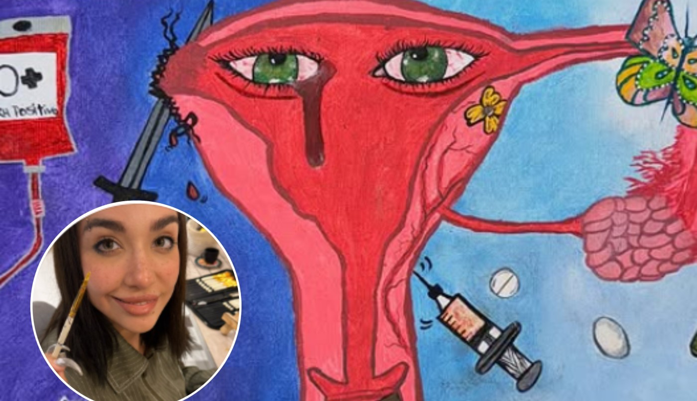 María Becerra desahogó la angustia de su embarazo ectópico en un cuadro: "Representa mucha oscuridad" | Espectáculos
