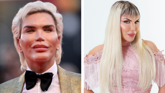De “Ken” a “Barbie”: Rodrigo Alves ahora es una mujer transgénero