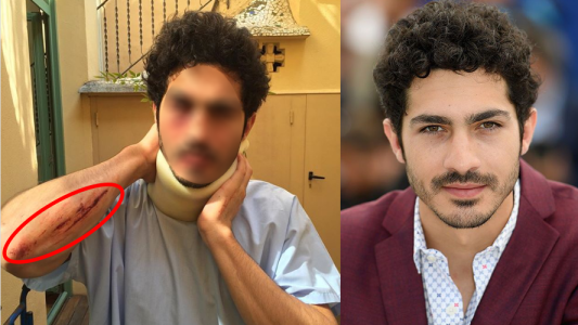 ¿Qué le pasó? Impactantes fotos de el Chino Darín