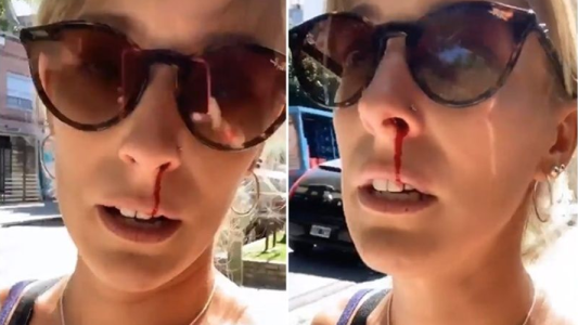 Violento intento de robo a Dani la Chepi