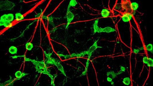 El impactante video que muestra cómo un cerebro destruye las neuronas muertas