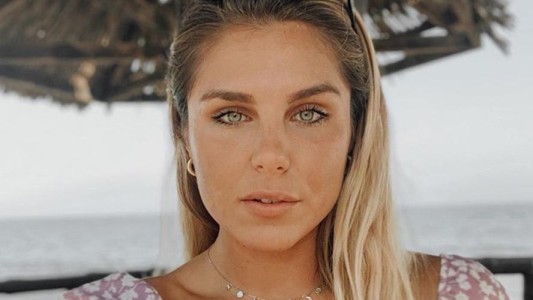 Ivana Icardi tuvo un imprevisto y amaneció con la cara deformada