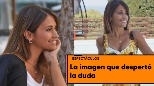 En las redes creen que Antonela Rocuzzo se hizo un retoque facial