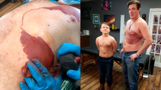 Se tatuó la mancha de nacimiento de su hijo para darle confianza