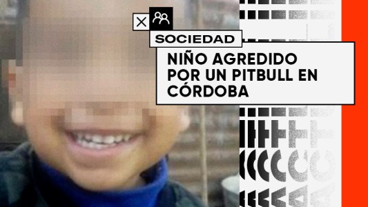 Polémica en Córdoba: un niño fue atacado por un pitbull