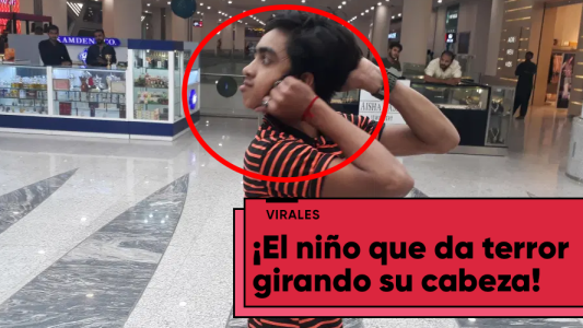 ¡Imágenes sensibles! Un adolescente de 14 años puede girar 180 grados su cabeza