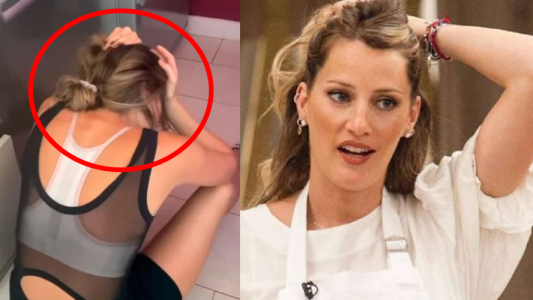 ¡Justo en la cabeza! Mica Viciconte sufrió un accidente doméstico