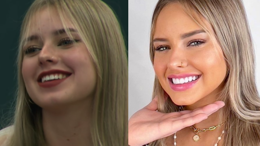 Coti Romero reveló retoques cara fuerte mensaje Preocúpense ustedes
